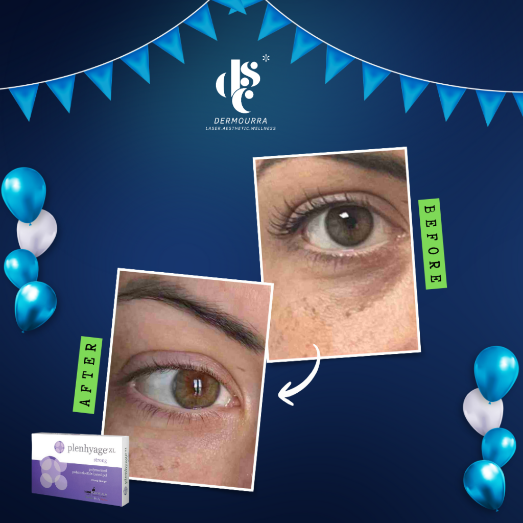 Dermourra Aesthetic- laser.aesthetic.wellness